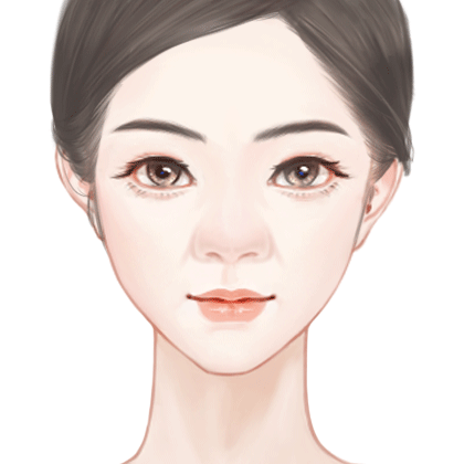 宽鼻矫正
