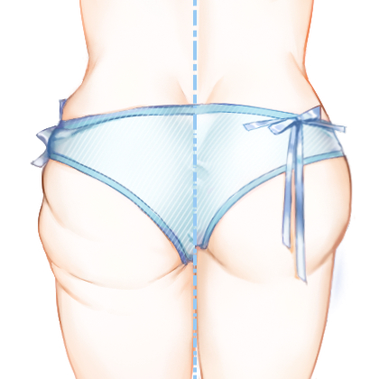 射频溶脂瘦臀部