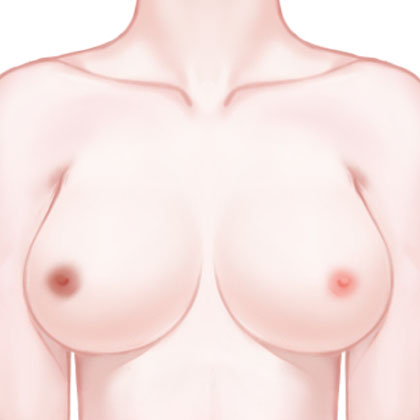 半永久乳晕漂红