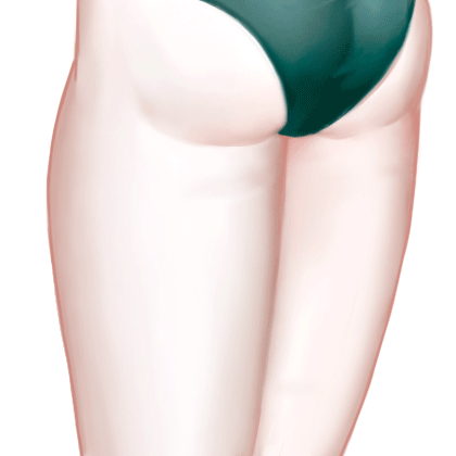 吸脂瘦大腿